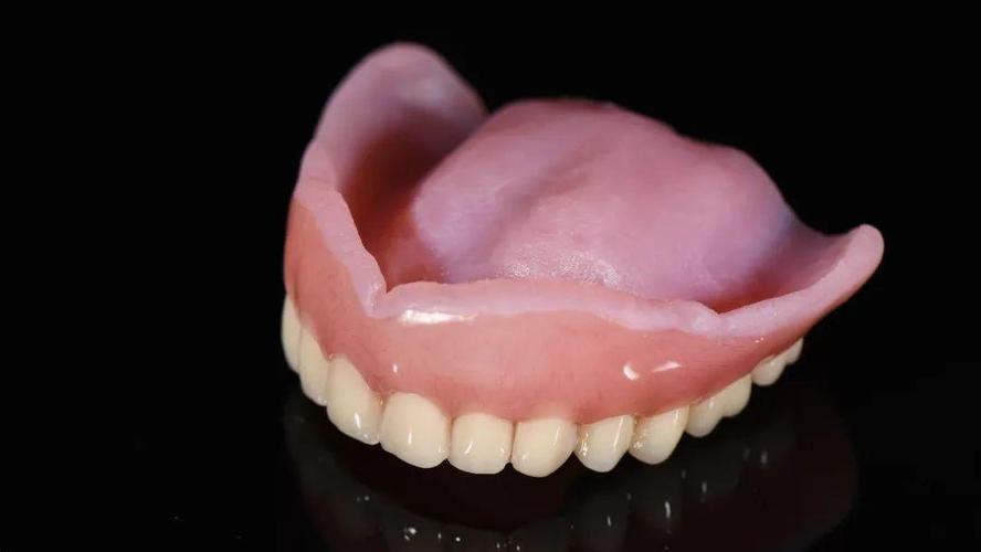 金赛义齿精制义齿修复病例